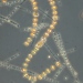 Kiselalgen Thalassiosira baltica ringlar sig som ett vackert smycke i detta mikroskop-fotografi från årets vårblomning. Foto:Helena Höglander